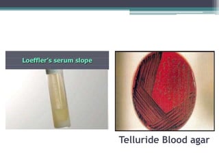 Telluride Blood agar
 