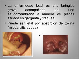 • La enfermedad local es una faringitis
  grave       acompañada        por  una
  seudomembrana a manera de placas
  situada en garganta y traquea
• Puede ser letal por absorción de toxina
  (miocarditis aguda)

                    .
 