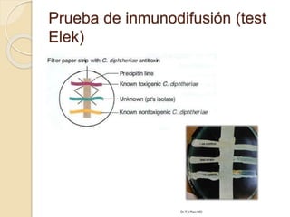 Prueba de inmunodifusión (test
Elek)
 