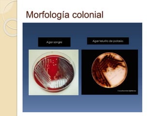 Morfología colonial
 