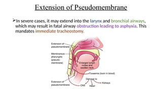 Extension of Pseudomembrane
In severe cases, it may extend into the larynx and bronchial airways,
which may result in fatal airway obstruction leading to asphyxia. This
mandates immediate tracheostomy.
 