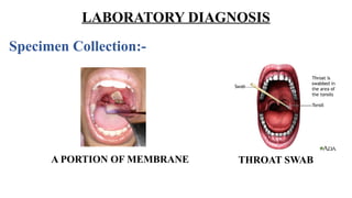 LABORATORY DIAGNOSIS
Specimen Collection:-
A PORTION OF MEMBRANE THROAT SWAB
 