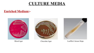 CULTURE MEDIA
Enriched Medium:-
Loeffler's Serum Slope
Chocolate Agar
Blood Agar
 
