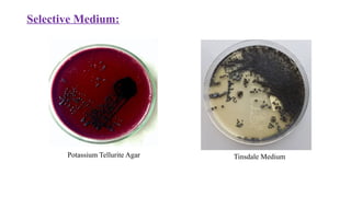 Selective Medium:
Potassium Tellurite Agar Tinsdale Medium
 