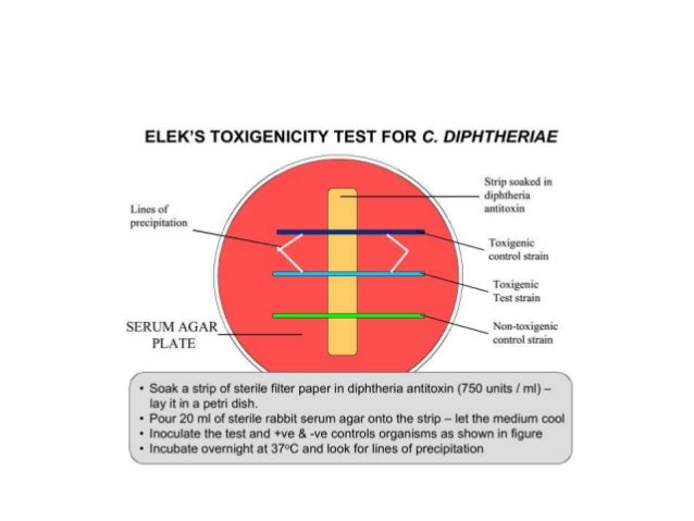 Corynebacterium diptheriae Corynebacterium diptheriae