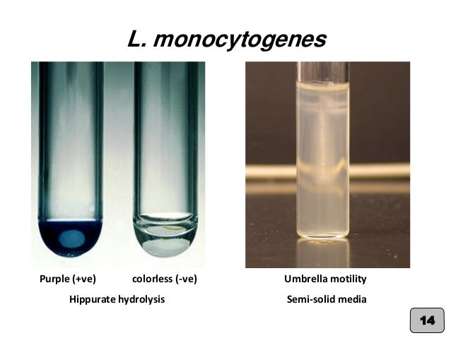 Corynebacterium spp. & Listeria monocytogenes (Practical Medical Micr…