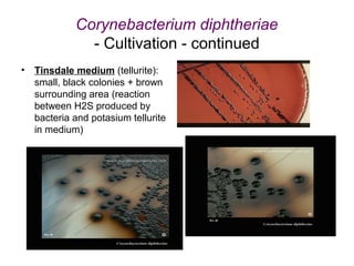 Corynebacterium diphtheriae
- Cultivation - continued
• Tinsdale medium (tellurite):
small, black colonies + brown
surrounding area (reaction
between H2S produced by
bacteria and potasium tellurite
in medium)
 