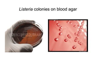 Listeria colonies on blood agar
 