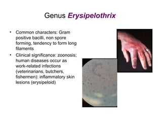 Genus Erysipelothrix
• Common characters: Gram
positive bacilli, non spore
forming, tendency to form long
filaments
• Clinical significance: zoonosis;
human diseases occur as
work-related infections
(veterinarians, butchers,
fishermen): inflammatory skin
lesions (erysipeloid)
 