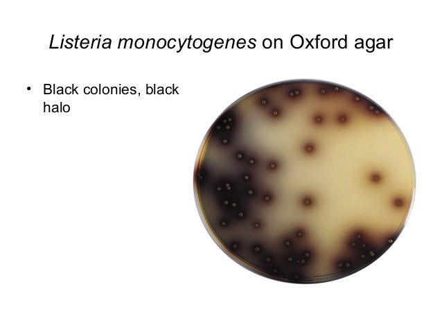 Corynebacterium listeria erysipelothrix_bacillus