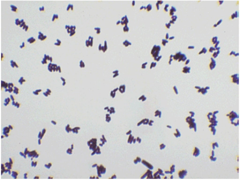 Corynebacterium spp в мазке у мужчин