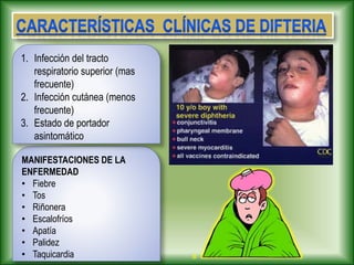 MANIFESTACIONES DE LA
ENFERMEDAD
• Fiebre
• Tos
• Riñonera
• Escalofríos
• Apatía
• Palidez
• Taquicardia
1. Infección del tracto
respiratorio superior (mas
frecuente)
2. Infección cutánea (menos
frecuente)
3. Estado de portador
asintomático
 