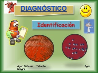 Agar Cisteína – Telurito Agar
Sangre
 