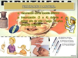  Vacunación con el toxoide diftérico
 Inmunización (3 a 4) durante el
primer año de vida y luego 10 años
después (toxoide)
 