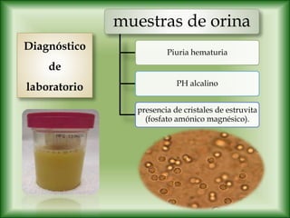 muestras de orina
Piuria hematuria
PH alcalino
presencia de cristales de estruvita
(fosfato amónico magnésico).
Diagnóstico
de
laboratorio
 