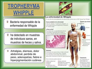 ha detectado en muestras
de individuos sanos, en
muestras de heces y saliva.
Artralgias, diarreas, dolor
abdominal, perdida de
peso, adenopatías, fiebre e
hiperpigmentación cutánea
Bacteria responsable de la
enfermedad de Whipple
 