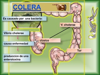 Vibrio cholerae
causa enfermedad
producción de una
enterotoxina
V. cholerae
Tor
clásico
Es causado por una bacteria:
 