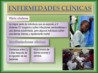 La mayor parte de individuos que se exponen a V.
cholerae O1 toxigénico sufren infecciones asintomáticas o
una diarrea autolimitada, pero algunos individuos sufren
una diarrea intensa y rápidamente mortal
Comienza entre 2 y
3 días después de
la ingestión de las
bacterias
Inicio brusco de
diarrea acuosa y
vómitos.
 