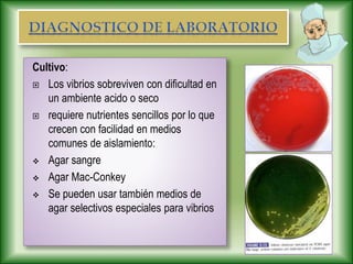 Cultivo:
 Los vibrios sobreviven con dificultad en
un ambiente acido o seco
 requiere nutrientes sencillos por lo que
crecen con facilidad en medios
comunes de aislamiento:
 Agar sangre
 Agar Mac-Conkey
 Se pueden usar también medios de
agar selectivos especiales para vibrios
 