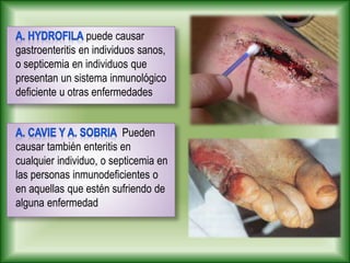 puede causar
gastroenteritis en individuos sanos,
o septicemia en individuos que
presentan un sistema inmunológico
deficiente u otras enfermedades
Pueden
causar también enteritis en
cualquier individuo, o septicemia en
las personas inmunodeficientes o
en aquellas que estén sufriendo de
alguna enfermedad
 