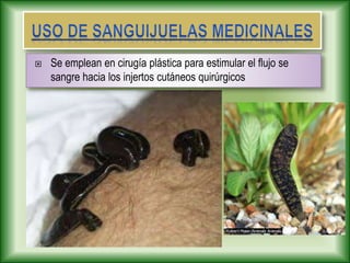  Se emplean en cirugía plástica para estimular el flujo se
sangre hacia los injertos cutáneos quirúrgicos
 