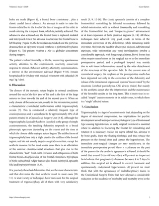 holes are made (Figure 6), a frontal bone craniotomy , plus a
classic caudal lateral advance. An attempt is made to raise the
fronto-orbital bar to the level of the lateral margins of the orbit, to
avoid entering the temporal fossa, which is partially achieved. The
advance is also achieved and the frontal bone is replaced, molded
and interposed. Once the advance is achieved, the frontal bone is
left floating (Figure 7), the hemostasis is checked and the portovac
drained, then an operative wound synthesis is performed by planes
(Figure 8). The patient receives a 300 cc globular concentrate
during surgery.
The patient evolved favorably, a febrile, recovering spontaneous
activity, attention to the environment, reactivity conserved,
response to stimuli. Behavior, activity, affectivity, communication,
e interest in the environment adecuad (Figure 9-10), remain
hospitalized for 10 days with medical treatment with cefazidal (30
mg / kg / day).
6. Discussion
The closure of the metopic suture begins in normal conditions
around the end of the first year of life and is the first of the large
sutures to close towards the end of the second year 6. When an
early closure of the same occurs, usually in the intrauterine period,
a characteristic craniofacial malformation called trigonocephaly
occurs [7]. This is considered a relatively frequent type of
craniosynostosis and is considered to be approximately 10% of all
patients treated in a Craniofacial Surgery Unit [5-8]. Although the
trigonocephaly classically has been classified in the group of simple
craniosynostosis, the resulting deformity responds to a broad
phenotypic spectrum depending on the extent and the time at
which the closure of the metopic suture begins. The milder forms of
trigonocephaly have only a slight crest in the midline of the frontal
region, and do not usually require surgical correction, except for
aesthetic reasons. In the most severe cases there is an affectation
of the anterior chondrocranial structures that give rise to the
characteristic “keel” front, with retrusion and obliqueness of both
frontal bones, disappearance of the frontal eminences, hypoplasia
of both supraorbital ridges that are also found destroyed, epicanth
fold and hypoteleorbitism [6, 9].
It is precisely these last deformities that are the most characteristic
and that determine the final aesthetic result in most cases [10,
11]. A wide variety of techniques have been used for the surgical
treatment of trigonocephaly, all of them with very satisfactory
result [5, 9, 12-14]. The classic approach consists of a complete
frontoorbital remodeling by bifrontal scranotomy followed by
orbital osteotomies, with or without disassembly and remodeling
of the frontoorbital bar, and "tongue-in-groove" advancement
or at least expansion of both pterional regions [6, 14]. All these
techniques have achieved very good results in terms of the
immediate correction of the deformities while remaining stable
over time. However, the need for a bicoronal incision, subperiosteal
exposure, wide osteotomies and bone mobilizations involve a
considerable approach, with long surgical times, blood losses that
often require transfusions in the surgical act or in the immediate
postoperative period, and a prolonged hospital stay mainly
due to soft tissue inflammation caused by the wide detachment
of the structures of the operative field. In the current state of
craniofacial surgery, the emphasis of the postoperative results has
been deposited not only in the correction of the deformity and
release of the intracranial organs and systems "incarcerated" by the
sinostosis (cerebral parenchyma, CSF, airway, vision) but mainly
in the aesthetic aspect after the intervention and the maintenance
of the favorable results in the long term. This is more true in so-
called "simple" craniosynostosis or in milder ones, in which there
is a "single" affected suture.
7. Conclusion
Trigonocephaly is a type of craniostenosis that, depending on the
degree of structural compromise, has implications for psychic
developmentaswellasimportantmorphologicaltypeoffrontonasal
type causing hypotelorism, so early surgical treatment is essential
where in addition to fracturing the frontal for remodeling and
rotation it is necessary release the supra orbital bar, advance it
by bone grafts, leave the floating forehead, and thus release the
pressure on the frontal lobes and correct the hypotelorism. The
immediate post-surgical changes are very satisfactory, in the
immediate postoperative period there is a pleasure on the part
of the parents for the aesthetic appearance achieved, it should be
noted that around 24 to 48 hours they will present an important
facial edema that progressively decreases between 4 to 7 days In
addition, this surgical act is allowed to correct, harmonic and
spontaneously, endocranial hypertension. At present we must
think that with the appearance of multidisciplinary teams in
the Craniofacial Surgery Units that have allowed a considerable
reduction in the incidence of morbidity and mortality even in the
Volume 2 Issue 3-2019 Case Report
https://clinicsofsurgery.com/ 3
 