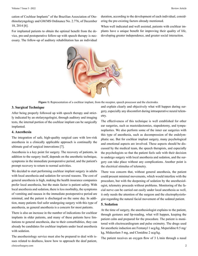 Surgical Technique of Cochlear Implantation: An Update | PDF