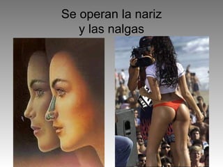 Se operan la nariz y las nalgas 