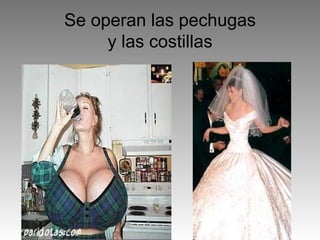 Se operan las pechugas y las costillas