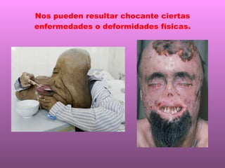 Nos pueden resultar chocante ciertas enfermedades o deformidades físicas. 