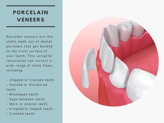 PORCELAIN
VENEERS
Porcelain veneers are thin
shells made out of dental
porcelain that get bonded
to the front surface of
your teeth. This versatile
restoration can correct a
wide range of smile flaws,
including:
• Chipped or cracked teeth
• Stained or discolored
teeth
• Misshapen teeth
• Gaps between teeth
• Worn or uneven teeth
• Irregularly shaped teeth
• Crooked teeth
 