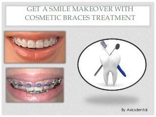 GET A SMILE MAKEOVER WITH
COSMETIC BRACES TREATMENT
By Axissdental
 