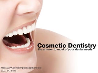 http://www.dentalimplantsportland.co/ (503) 847-9246 