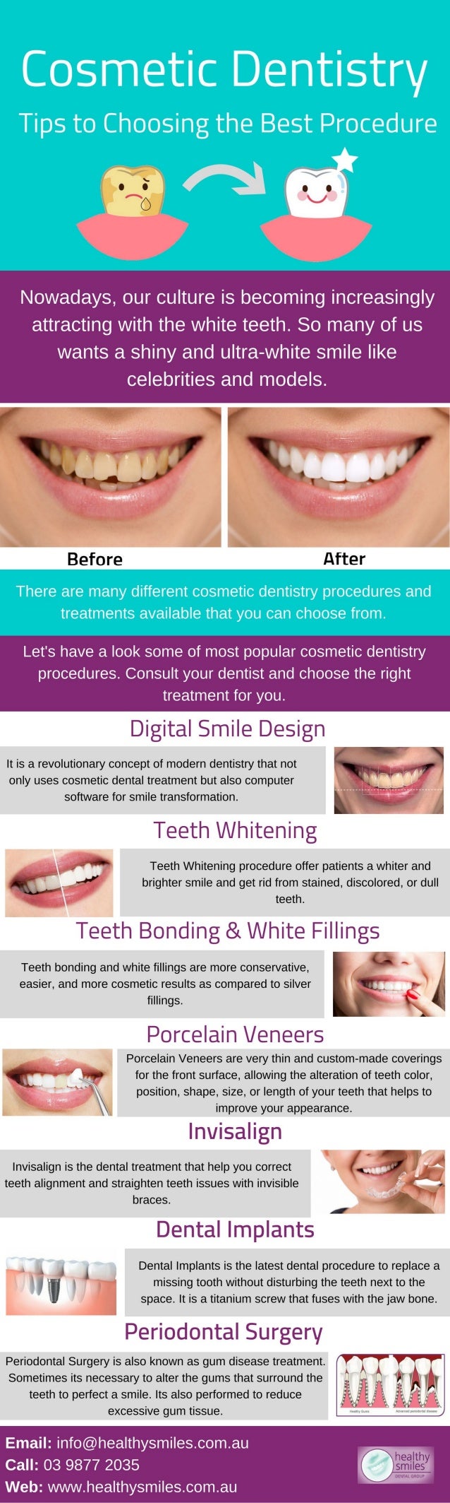 Cosmetic Dentistry Procedure and Treatment