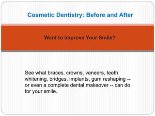 Cosmetic Dentistry: Before and After
Want to Improve Your Smile?
See what braces, crowns, veneers, teeth
whitening, bridges, implants, gum reshaping --
or even a complete dental makeover -- can do
for your smile.
 