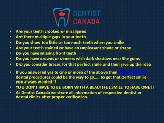 • Are your teeth crooked or misaligned
• Are there multiple gaps in your teeth
• Do you show too little or too much teeth when you smile
• Are your teeth stained or have an unpleasant shade or shape
• Do you have missing front teeth
• Do you have crowns or veneers with dark shadows near the gums
• Did you consider braces for that perfect smile and then give up the idea
• If you answered yes to one or more of the above then cosmetic
dental procedures could be the way to go….. to get that perfect smile
you always wanted !!
• YOU DON’T HAVE TO BE BORN WITH A BEAUTIFUL SMILE TO HAVE ONE !!
• At Dentist Canada we share all information of respective dentist or
dental clinics after proper verification.
 