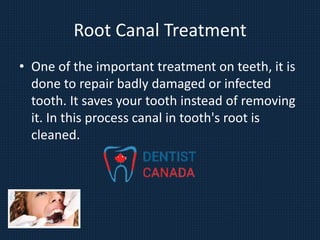 Root Canal Treatment
• One of the important treatment on teeth, it is
done to repair badly damaged or infected
tooth. It saves your tooth instead of removing
it. In this process canal in tooth's root is
cleaned.
 