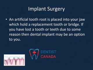 Implant Surgery
• An artificial tooth root is placed into your jaw
which hold a replacement tooth or bridge. If
you have lost a tooth or teeth due to some
reason then dental implant may be an option
to you.
 