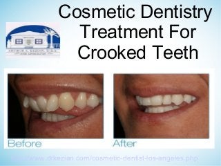 Cosmetic Dentistry
Treatment For
Crooked Teeth
http://www.drkezian.com/cosmetic-dentist-los-angeles.php
 