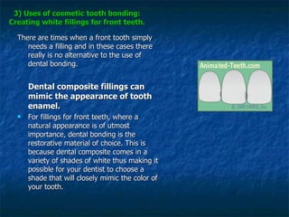 3) Uses of cosmetic tooth bonding: Creating white fillings for front teeth. There are times when a front tooth simply needs a filling and in these cases there really is no alternative to the use of dental bonding.  Dental composite fillings can mimic the appearance of tooth enamel. For fillings for front teeth, where a natural appearance is of utmost importance, dental bonding is the restorative material of choice. This is because dental composite comes in a variety of shades of white thus making it possible for your dentist to choose a shade that will closely mimic the color of your tooth.  