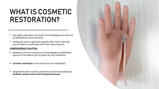 Cosmetic Restoration and silicone finger Prosthesis | PPTX