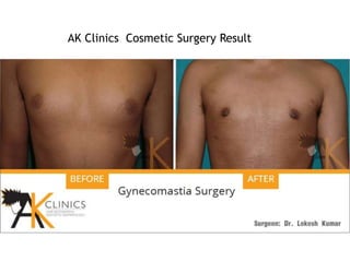 AK Clinics Cosmetic Surgery Result
 