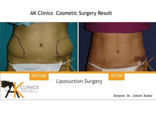 AK Clinics Cosmetic Surgery Result
 