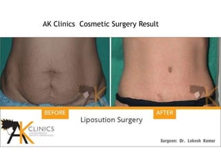 AK Clinics Cosmetic Surgery Result
 