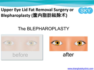 Upper Eye Lid Fat Removal Surgery or
Blepharoplasty (֬)
www.shanghaiskyclinic.com
 