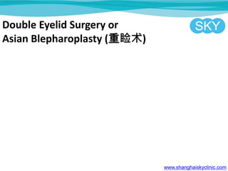 Double Eyelid Surgery or
Asian Blepharoplasty ()
www.shanghaiskyclinic.com
 