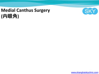Medial Canthus Surgery
(۽)
www.shanghaiskyclinic.com
 