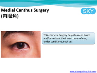 Medial Canthus Surgery
(۽)
This cosmetic Surgery helps to reconstruct
and/or reshape the inner corner of eye,
under conditions, such as:
www.shanghaiskyclinic.com
 