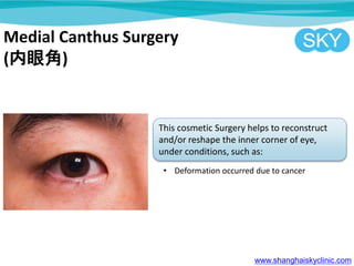 Medial Canthus Surgery
(۽)
This cosmetic Surgery helps to reconstruct
and/or reshape the inner corner of eye,
under conditions, such as:
? Deformation occurred due to cancer
www.shanghaiskyclinic.com
 