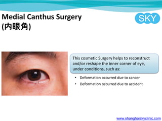 Medial Canthus Surgery
(۽)
This cosmetic Surgery helps to reconstruct
and/or reshape the inner corner of eye,
under conditions, such as:
? Deformation occurred due to cancer
? Deformation occurred due to accident
www.shanghaiskyclinic.com
 